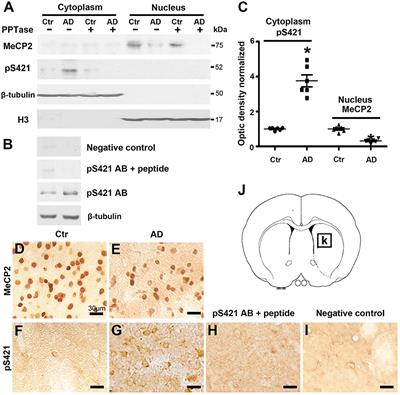 AD7c-NTP Impairs Adult Striatal Neurogenesis by Affecting the Biological Function of MeCP2 in APP/PSl Transgenic Mouse Model of Alzheimer's Disease